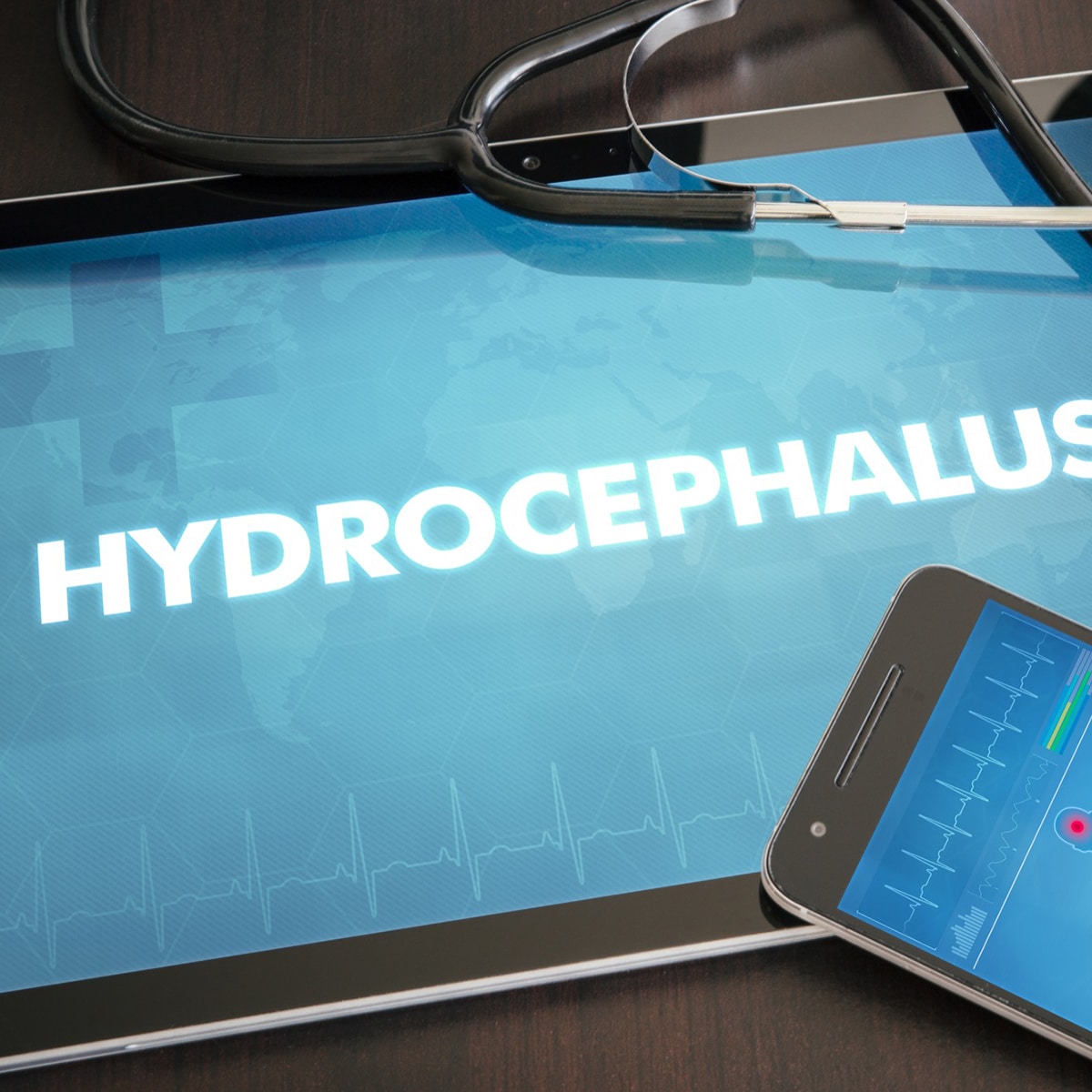 DYK: Hydrocephalus and urinary incontinence issues